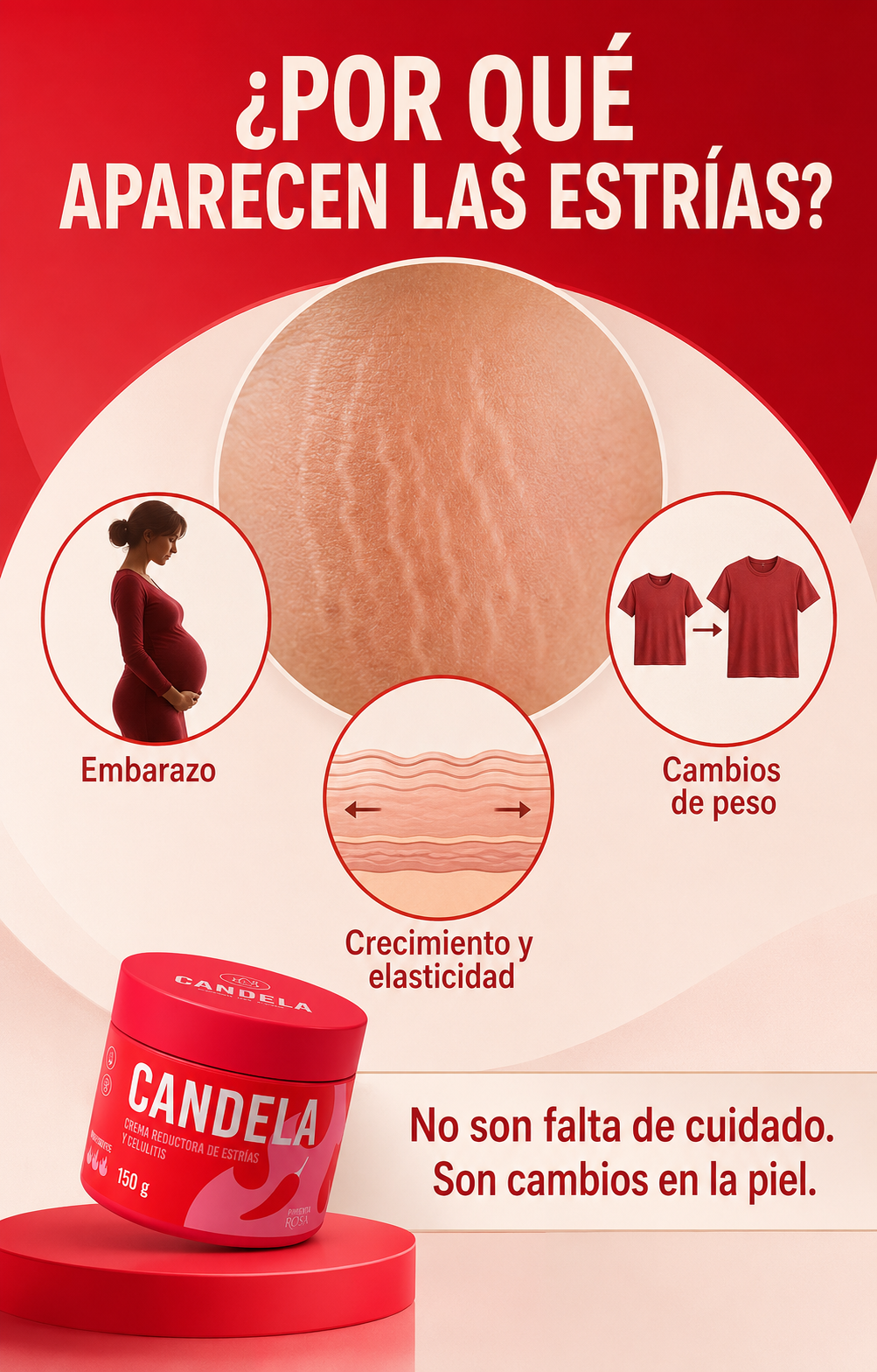 Por qué aparecen las estrías